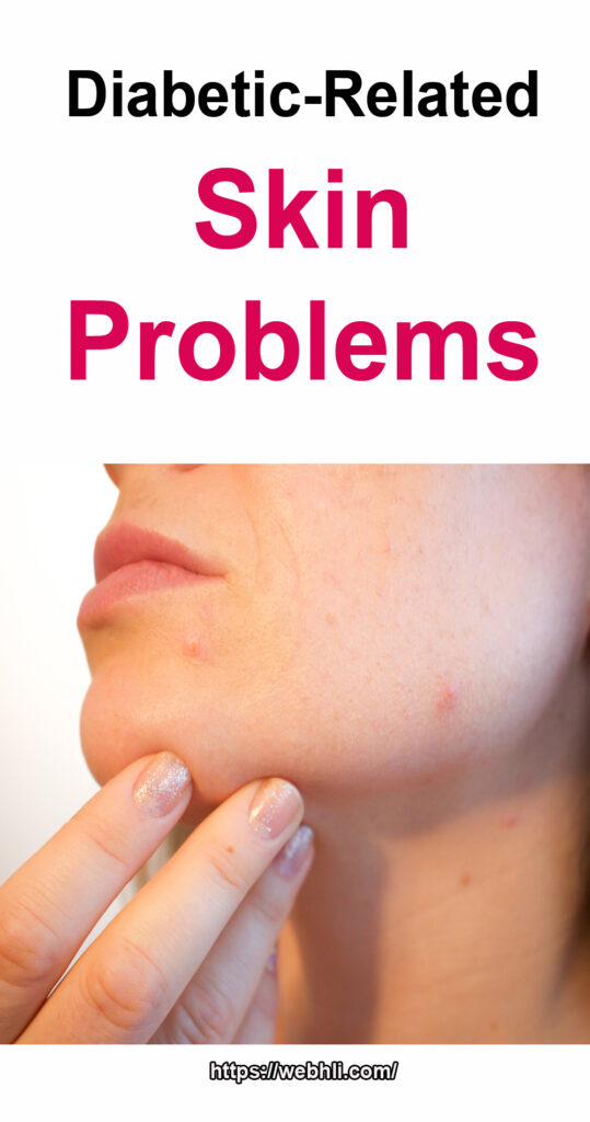 Diabetic Related Skin Problems Healthy Lifestyle