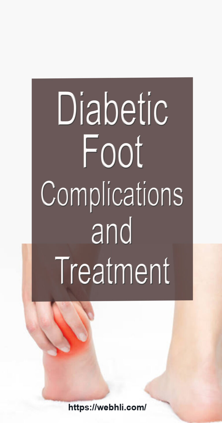 Diabetic Foot Complications and Treatment | Healthy Lifestyle