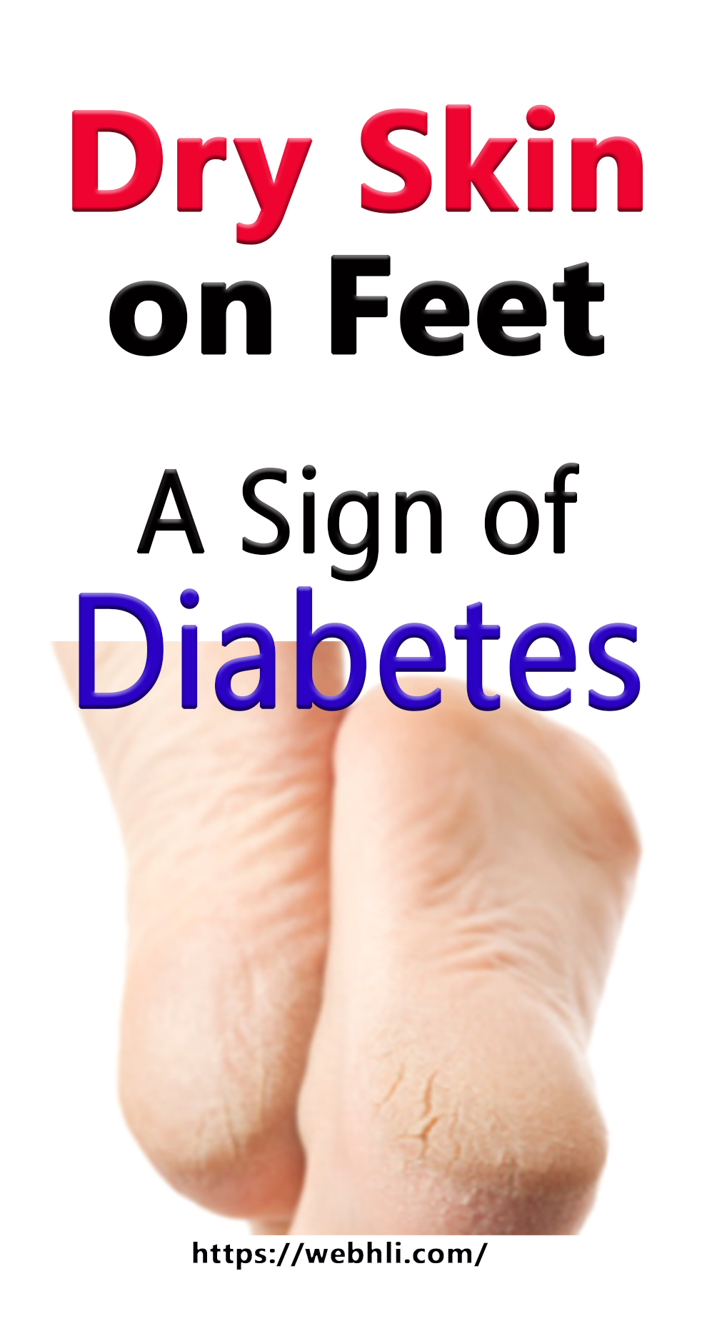 dry-skin-on-feet-a-sign-of-diabetes-healthy-lifestyle