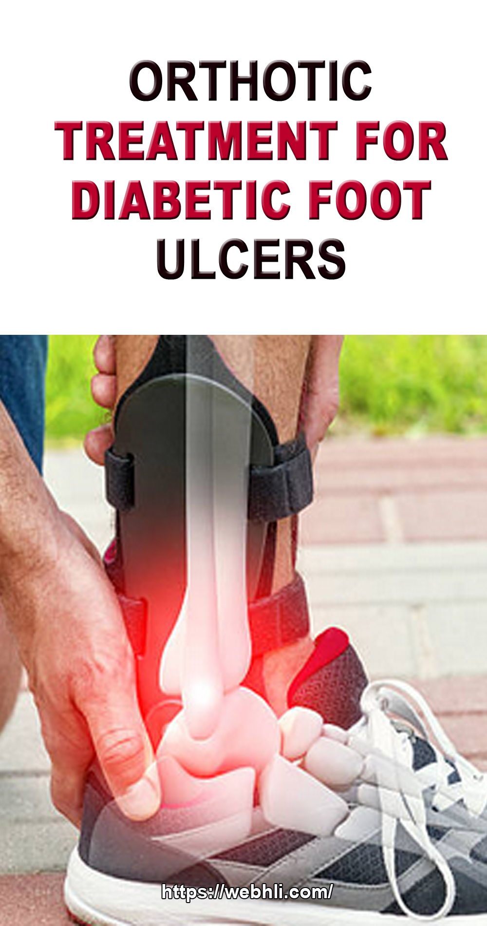 Orthotic Treatment for Diabetic Foot Ulcers Healthy Lifestyle