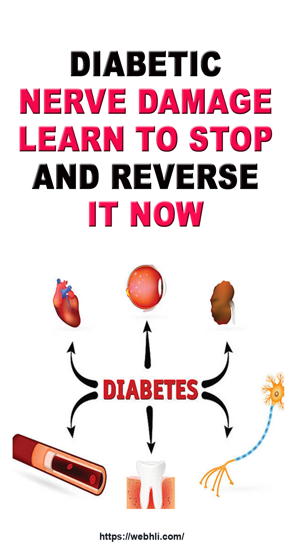 Diabetic Nerve Damage Learn to Stop and Reverse It Now Healthy
