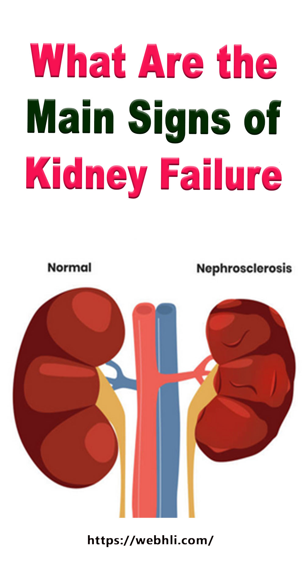 What Are the Main Signs of Kidney Failure | Healthy Lifestyle