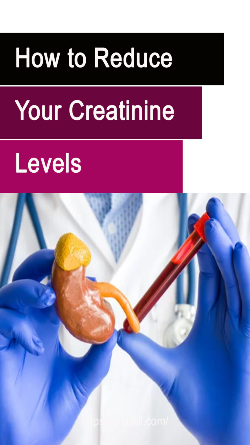 How to Reduce Your Creatinine Levels- A Comprehensive Guide | Healthy ...